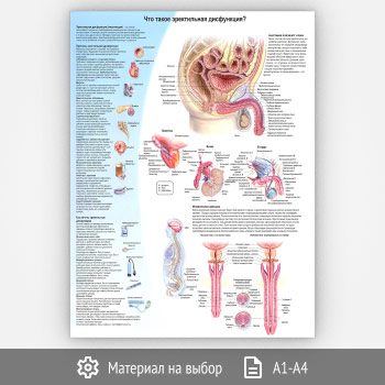 Плакат «Что такое эректильная дисфункция?» (ЗОЖ-46, 1 лист)